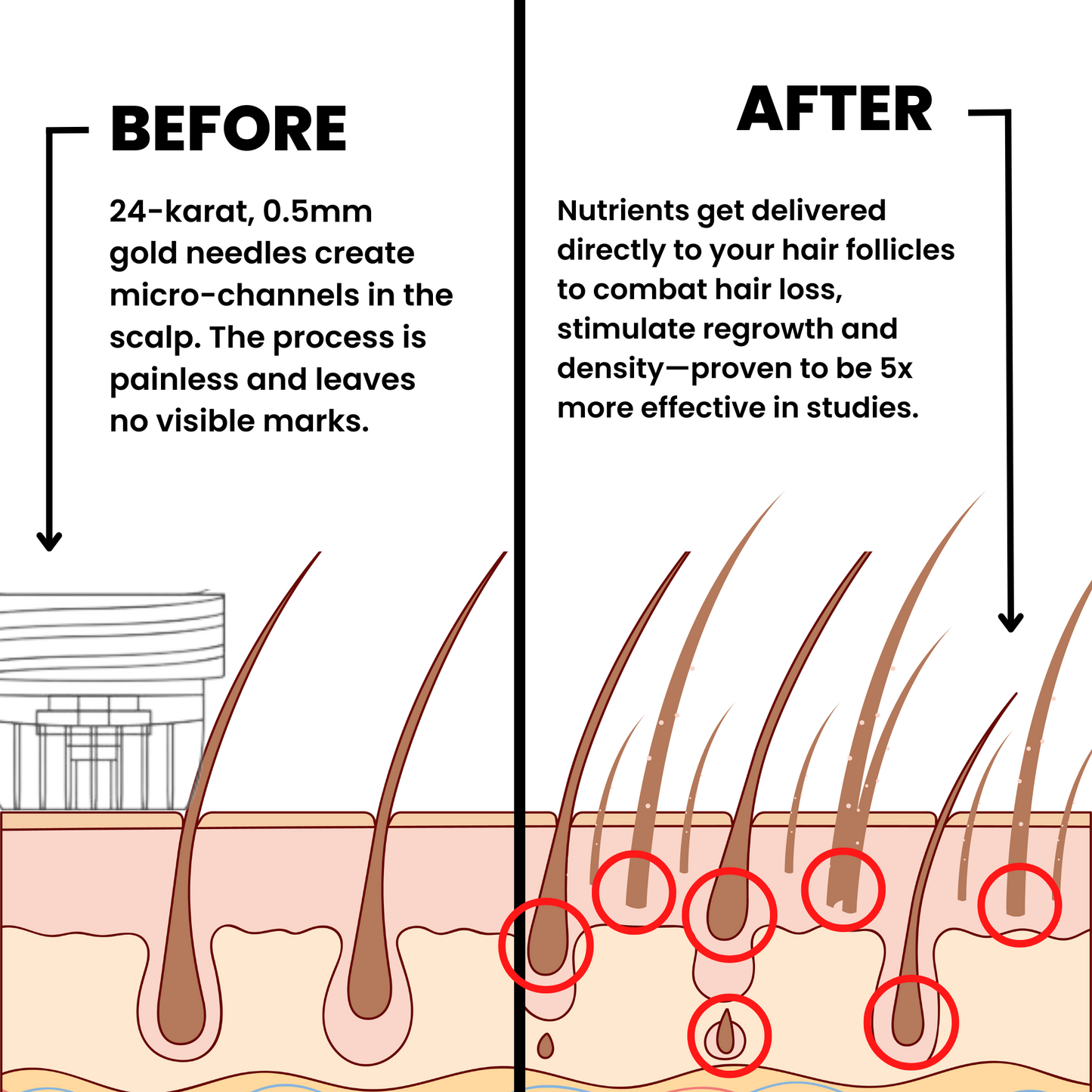 Trugro™ Hair Regrowth Kit