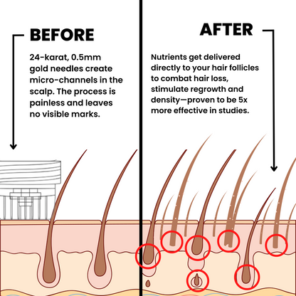 Trugro™ Hair Regrowth Kit